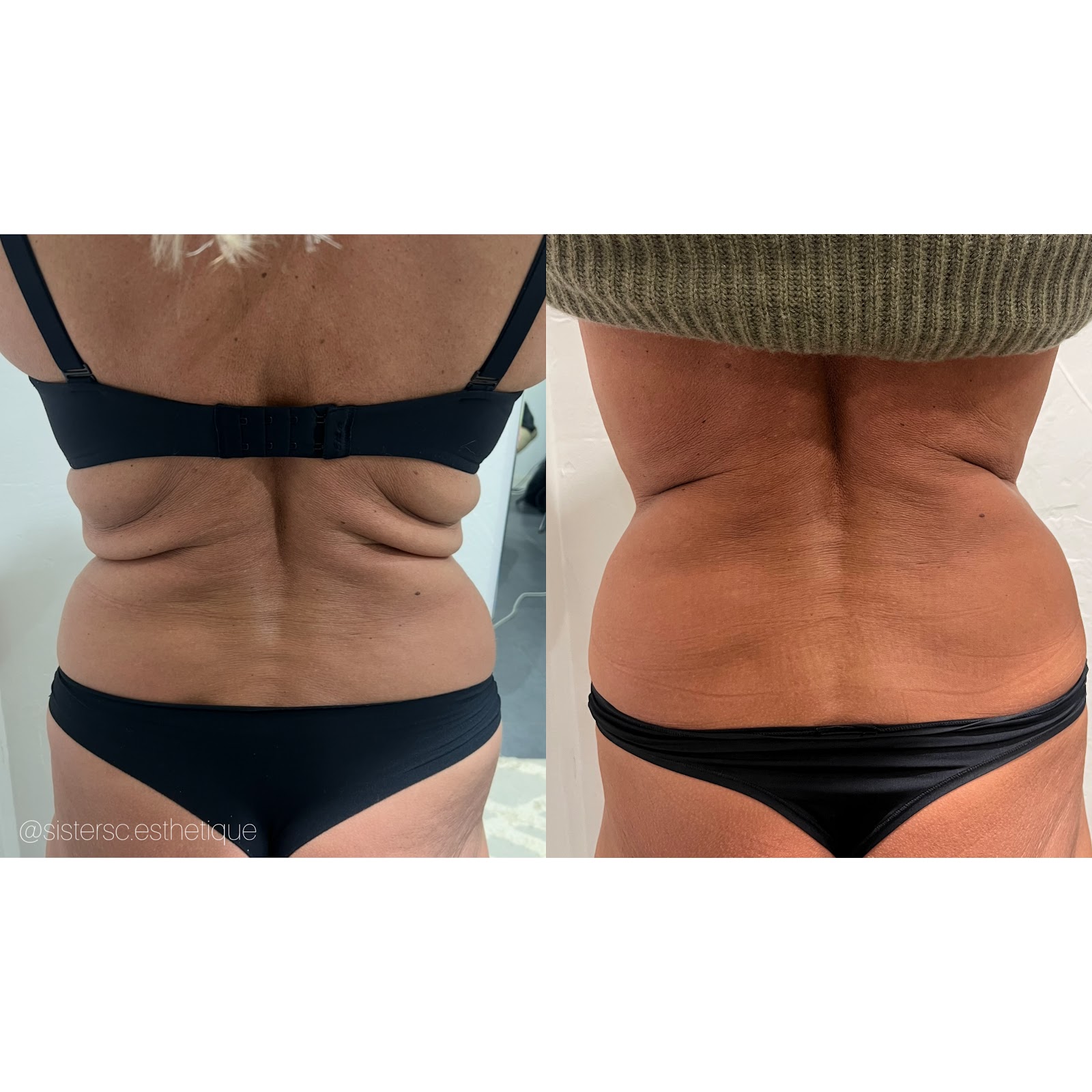 Sisters centre esthétique