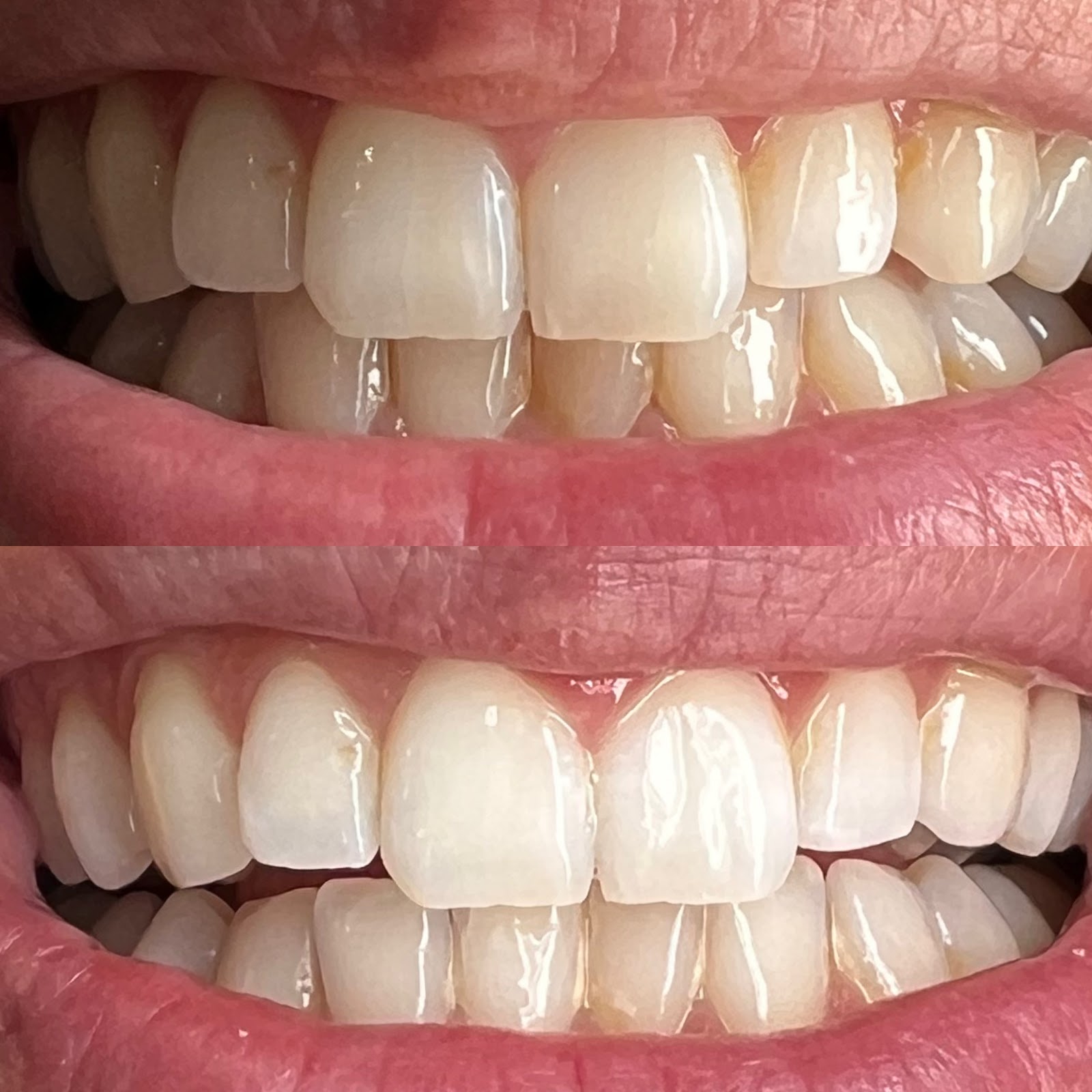 Épilation au laser Soûl and Skin Expert